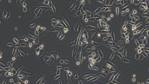 20180822-113821-187_Mia PaCa-2.png